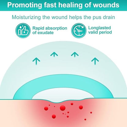 Dimora Hydrocolloid Dressing 4" x 4" for Wound Care, 10 Pcs Large Patch Bandages with Self-Adhesive for Bedsore, Burn, Blister, Acne Care, Super Absorbent for Fast Healing
