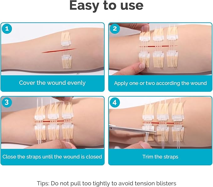 Emergency Wound Closure Strips - 5 Pcs Zip Stitch Butterfly Bandages Wound Closure Kit - Painless Steri Strips Laceration Kit for Wound Care - Zip Tie Adhesive Bandaids