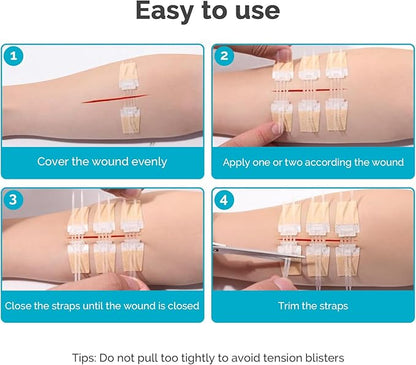 Emergency Wound Closure Strips - 5 Pcs Zip Stitch Butterfly Bandages Wound Closure Kit - Painless Steri Strips Laceration Kit for Wound Care - Zip Tie Adhesive Bandaids
