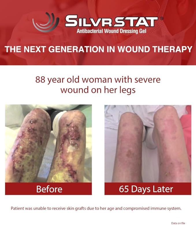 SilvrSTAT First Aid Kit Gel, 32 PPM Silver Healing Wound Dressing Solution, SilverSol Ag₄O₄ Particles, 3 oz