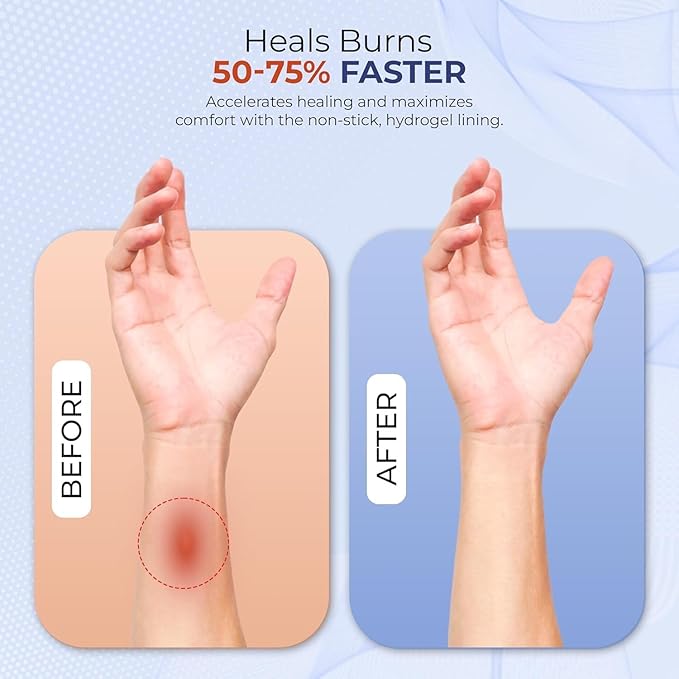 BurnFIX® Burn Kit First Aid Recommended by Doctors, Comprehensive 25pcs First Aid Kit Includes Burn Gel, Burn Dressing, Gloves, Scissors, Wipes for Quick Burn Relief - Sunburn, Electrical, Flame Burns