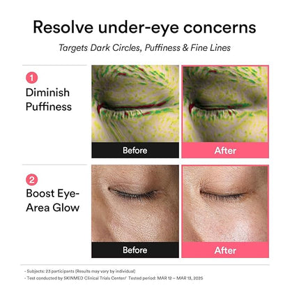 Abib PDRN Retinal Eye Patch, Hydrogel Masks for Dark Circles, Puffiness, Fine Lines, 60 Patches, 84g, with Niacinamide, K-Beauty Skincare