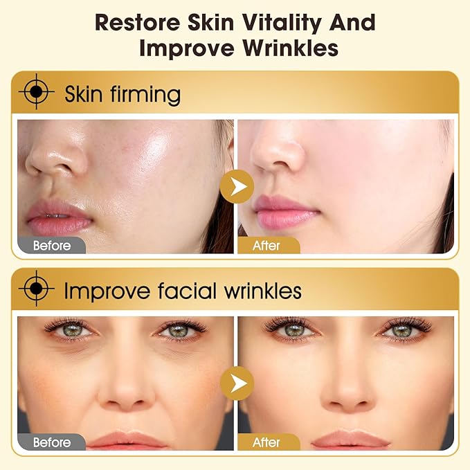 Ecdoin Anti-Aging Essence, Ecdoin Anti Wrinkle Serum, 2 PCS Nuosili Face Lift Spray,Moisturize and Tighten Skin Improve Wrinkles, for All Skin Types