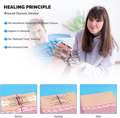 Emergency Wound Closure Device 10 Pcs Zip Stitch Wound Closure Strips Laceration Kit Sutures Bandaids for Wounds Repair Without Sew Quick Clot First Aid Wound Care for Outdoor Hiking