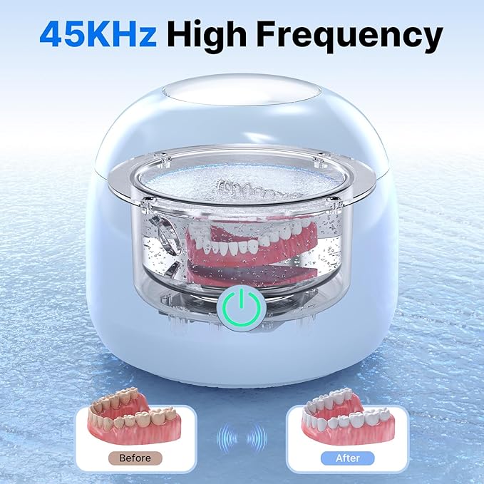 Ultrasonic Retainer Cleaner - UV Dental Cleaning Pod Night Guard Cleaner for Dentures, Aligner, Braces, Toothbrush Heads, Jewelry (Blue)