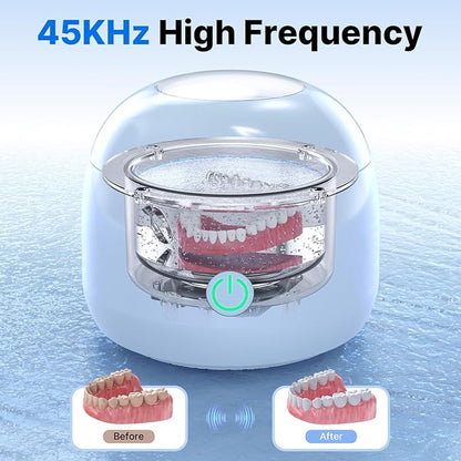 Ultrasonic Retainer Cleaner - UV Dental Cleaning Pod Night Guard Cleaner for Dentures, Aligner, Braces, Toothbrush Heads, Jewelry (Blue)