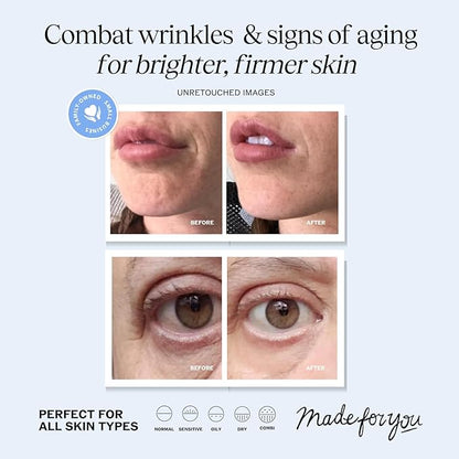 LilyAna Naturals Anti Aging Retinol Face Cream for Women – Wrinkle & Neck Cream for Firming, Retinol Moisturizer for Face with Hyaluronic Acid, Hydrating Night Cream for Fine Lines, Collagen Boost