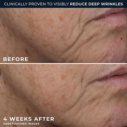 RoC Deep Wrinkle Rich Cream, Fragrance Free, Daily Anti-Aging Firming Cream For Persistent Dryness & Younger-Looking Skin For Women & Men, With Line Smoothing Eye Cream Packette, 1.7oz